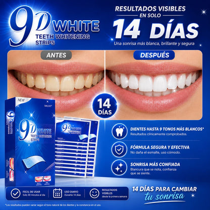 Sonrisa radiante en 14 Dias